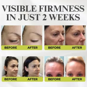 Sylovona Glow Vita-A Retinol Shot Wrinkle-Lift Tightening Cream