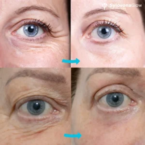 Sylovona Glow Instant Lift & Brighten Peptide Eye Cream