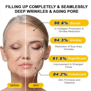 Rolimey® Botox & Vita A Retinol Shot Tightening Cream