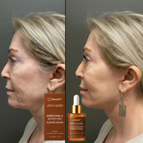 SkinLift™ Lifts Sagging Skin