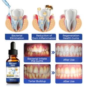 Natravor Beetakt Oral Repair Solution Mouthwash