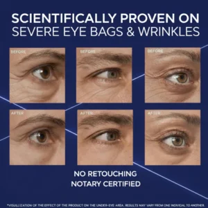 Eye Skincare Under-Eye Bag Cream Barubt