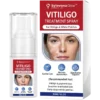 Sylovona Glow Vitiligo Treatment Spray