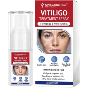 Sylovona Glow Vitiligo Treatment Spray
