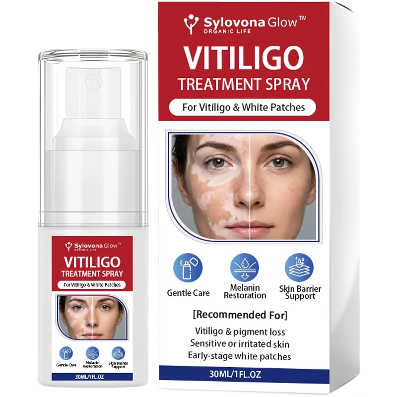 Sylovona Glow Vitiligo Treatment Spray