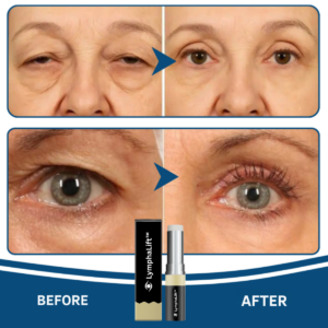 LymphaLift Balm Stick