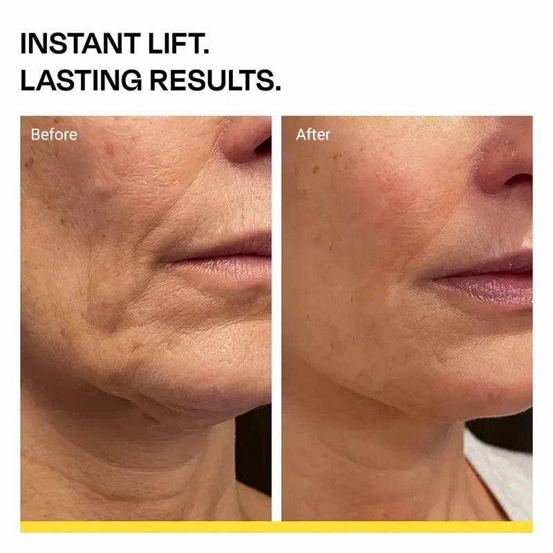 Sylovona Glow Dual Action Lifting Cream