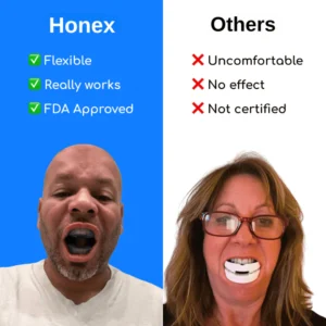 Honex Anti-Snoring Mouthpiece