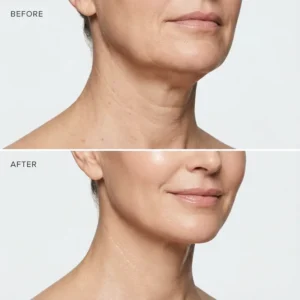 Orelvique Collagen Anti-Aging Moist Spray