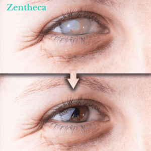 Reliefogix Vision Care Roller