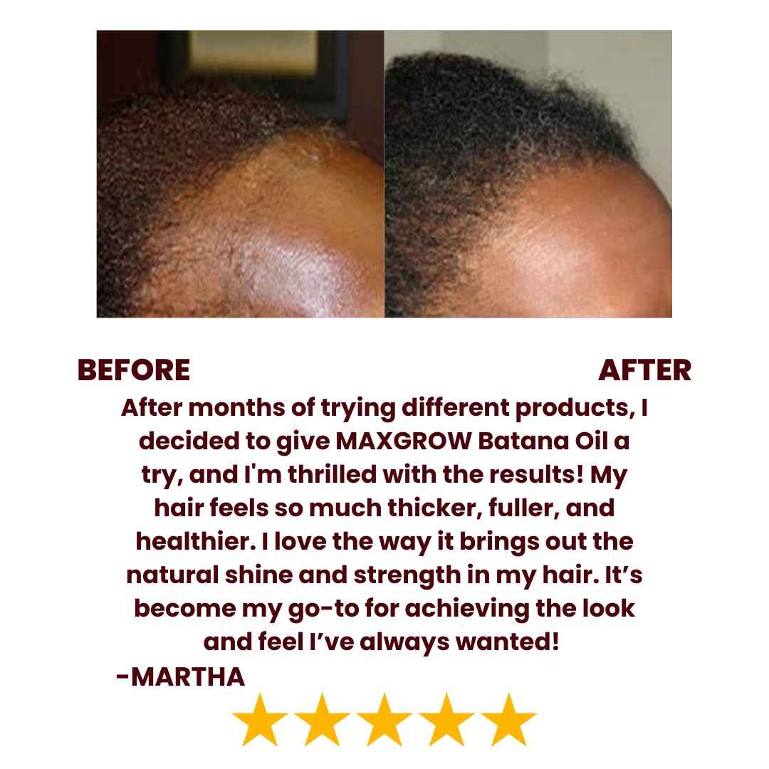 Maxgrow Batana Natural Hair Growth Oil