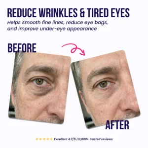 Oros Dissolving Microneedle Eye Patches for Men