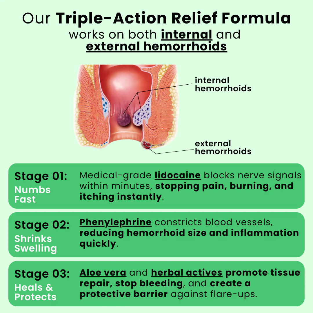 Illura Hemorrhoid Ointment with Aloe