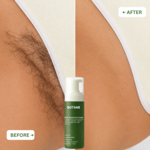 BOTANE Hair Removal Cream