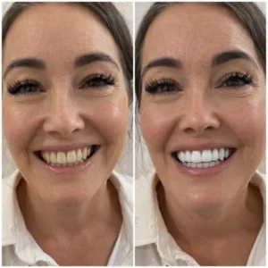 Sylovona Glow Simply White Teeth Whitening Powder