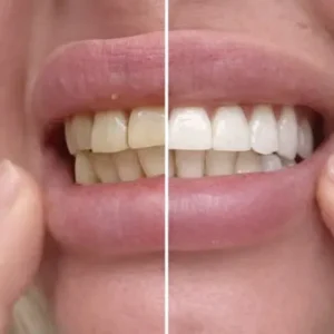 Sylovona Glow Simply White Teeth Whitening Powder